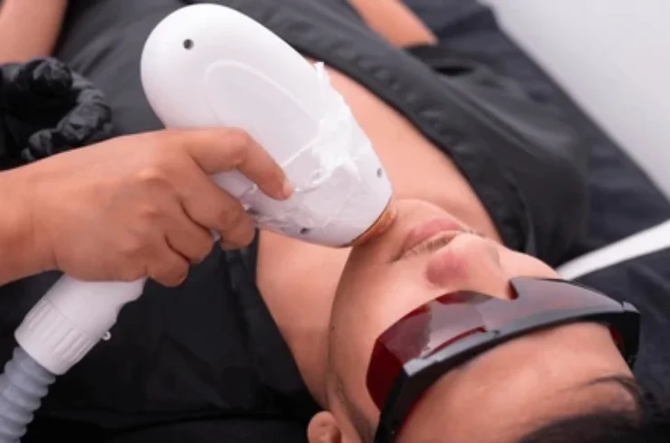 Laser Hair Reduction------11